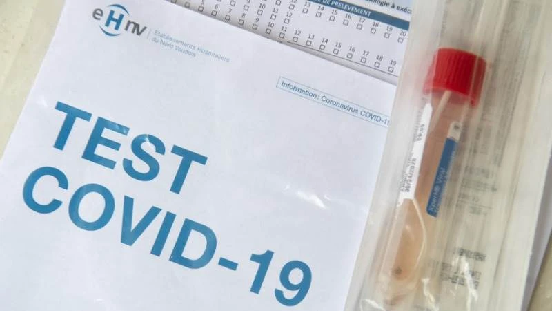 Šeranić: Godišnji odmor 'zaledio' testiranja na virus korona