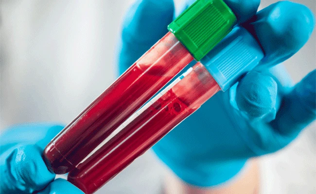 Znanstvenici razvili test krvi koji predviđa šanse za smrt