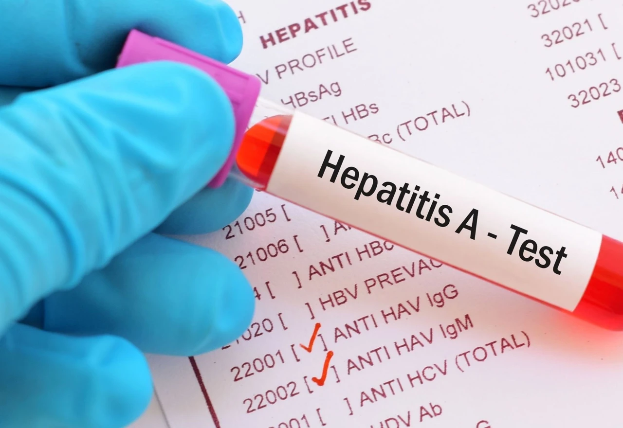 Infekcije hepatitisa A povećane za 300 posto