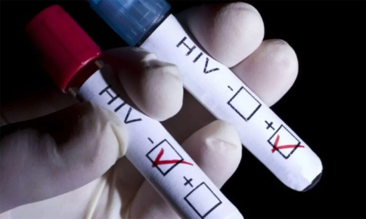 ''Svaka mogućnost da uništavamo HIV veliki je pomak za čovječanstvo''