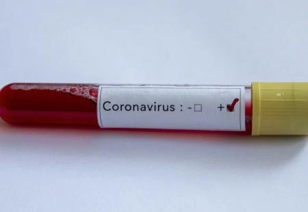 Hrvatska: Preminulih 34, potvrđeno 1.427 novozaraženih koronavirusom