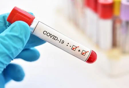 Covid u HNŽ-u: Preminule dvije osobe, 35 novih pozitivnih slučajeva 