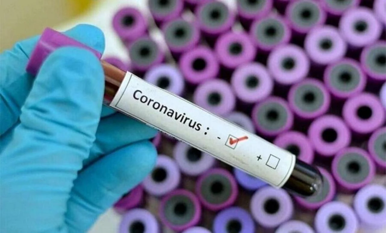 Novih 14 zaraženih u RS-u 