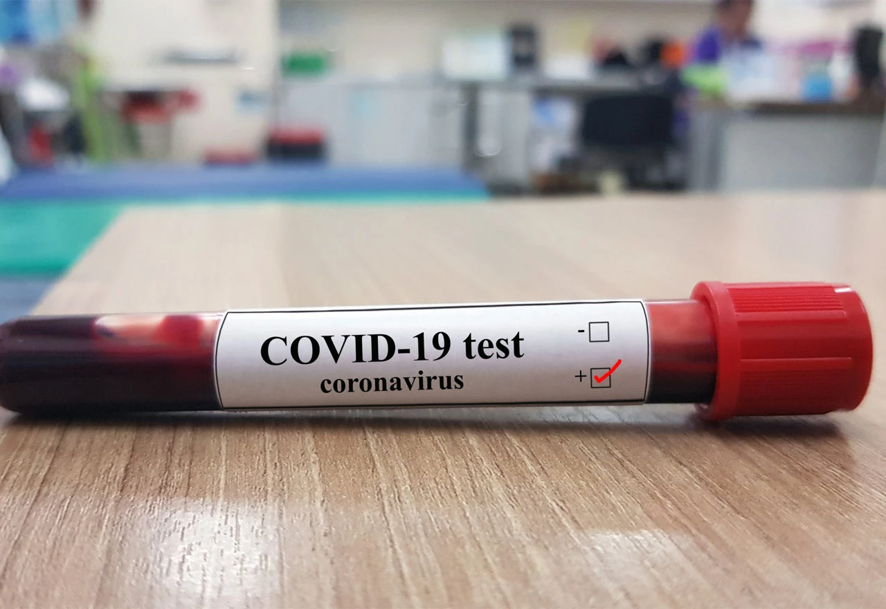 Nove brojke: 411 zaraženih u BiH 