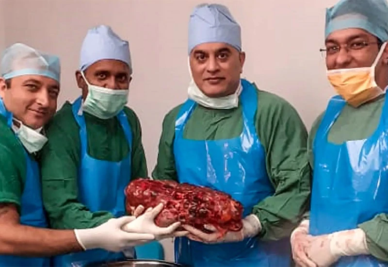 Liječnici uklonili bubreg težak 7,4 kilograma