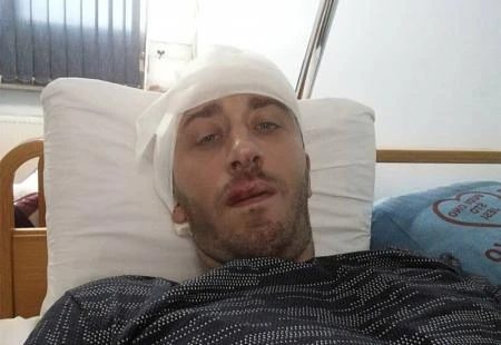 Istraga napada na novinara: Saslušano više od 20 osoba