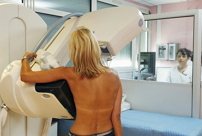 Mamografski pregled u ŽZH obavilo 220 žena