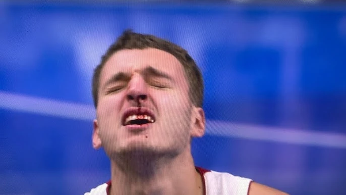 VIDEO I Bilo krvi u Detroitu, Joviću stradao nos, Hardawayu Junioru glava