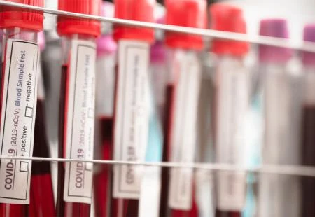 HNŽ: Od 291 testiranih devet pozitivnih