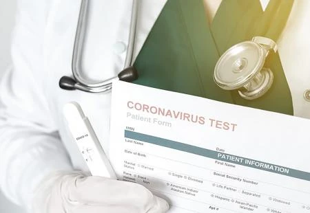 Odluka: Nova cijena komercijalnog testa na covid