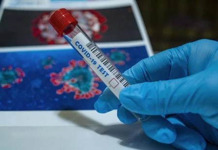 Obavijest za građane Hercegbosanske županije o testiranju na Covid-19