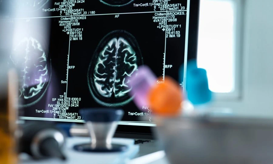 Koronavirus ne napada samo pluća već i mozak