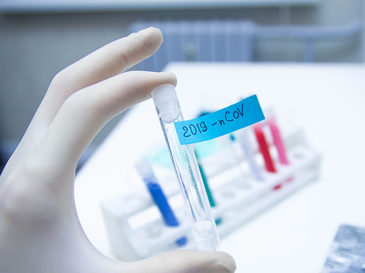 Mostar bez zaraženih, virus korona potvrđen kod 22 osobe u RS