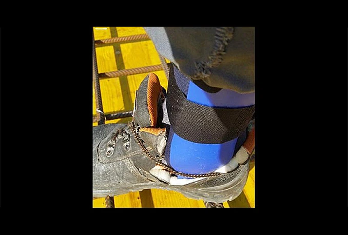 Poslodavac iz BiH natjerao radnika da radi s potrganim ligamentima