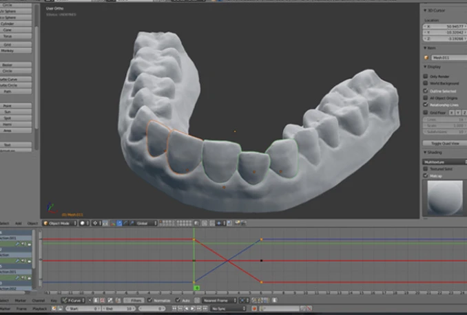 Do savršenog osmijeha pomoću 3D printera i malo snalažljivosti