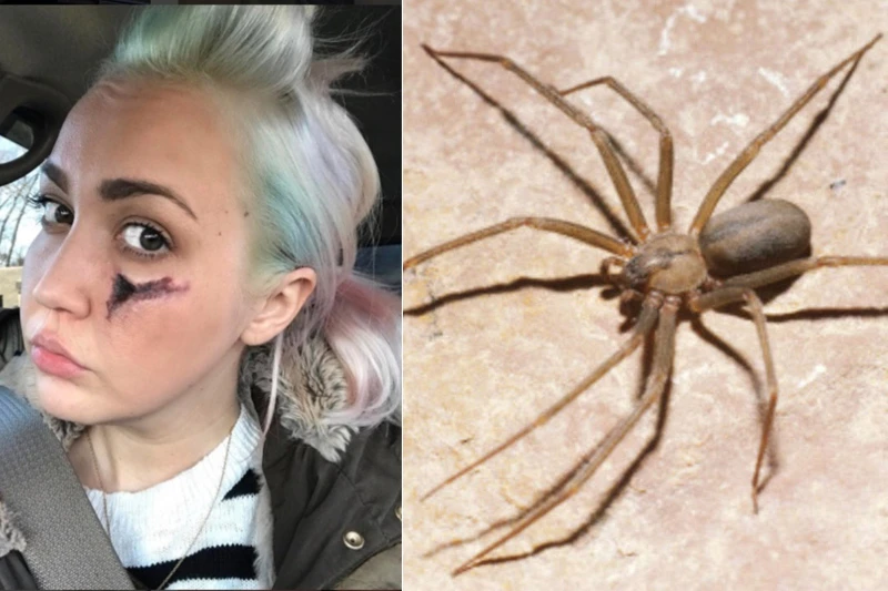 Kako je pjevačici Meghan Linsey ostala crna rupa u licu