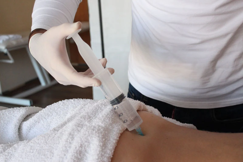 Epiduralna anestezija - uz pomoć ovog tretmana rješite križobolju i išijas