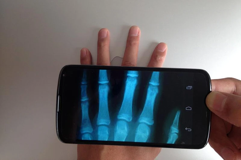 Pametni telefoni donose revoluciju u medicini
