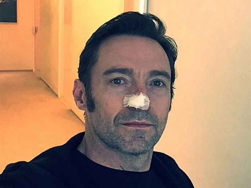 Wolverine po šesti put operirao rak