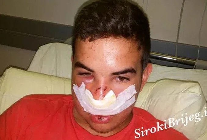 Policija i tužiteljstvo: Dječak iz Širokog Brijega još službeno nije pretučen