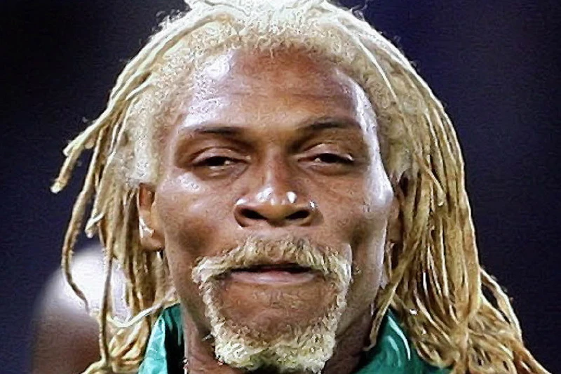 Rigobert Song se probudio iz kome
