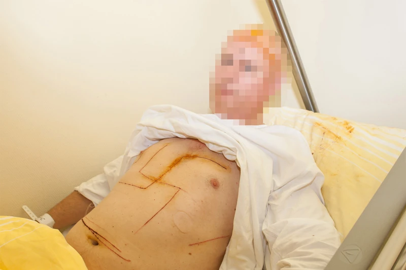 Urezao kukasti križ na vlastitome tijelu pa optužio susjede