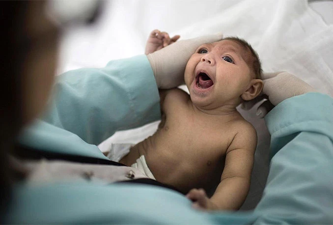 Zika virus uzrokuje gubitak sluha