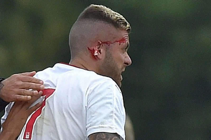 Menez imao horor debi za Bordeaux