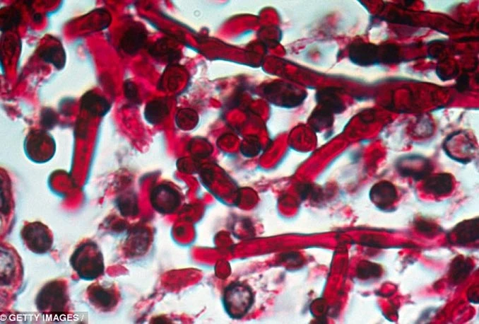Candida auris – Infekcija kojoj lijekovi ne mogu ništa