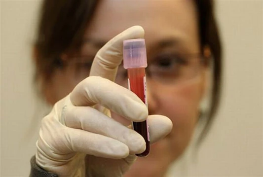 Nijedan nogometaš na EURO-u nije bio pozitivan na doping testu