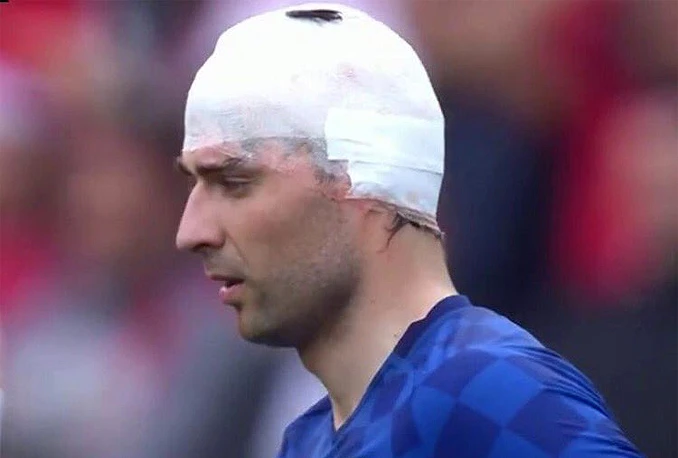 Nasmijani Ćorluka: Kada su mi zavili uši malo sam slabije čuo