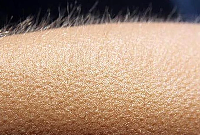 Zašto glazba izazove trnce