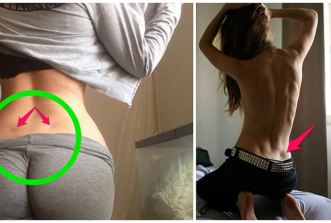 Što znače rupice na leđima?