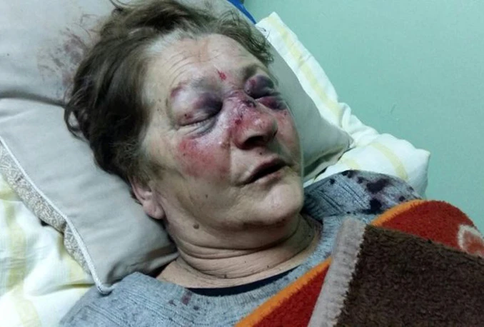 Prijedor: 19-godišnjaci brutalno pretukli povratnicu radi 500 KM