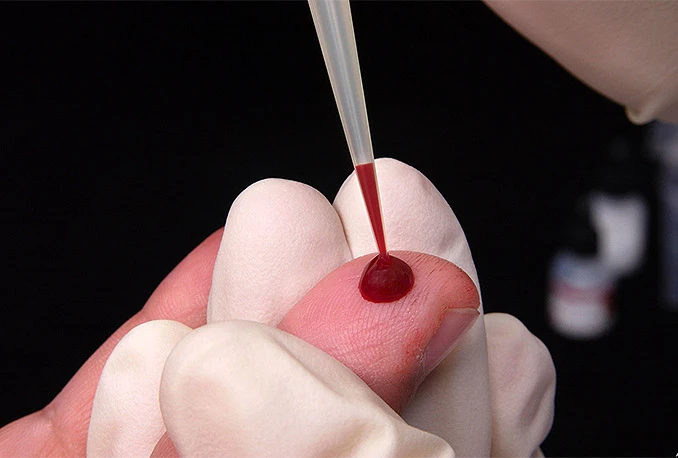 BiH: Od HIV-a boluje 266 osoba