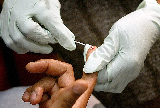 Zabilježen rekordan broj oboljelih od HIV-a: Trećina oboljelih imigranti