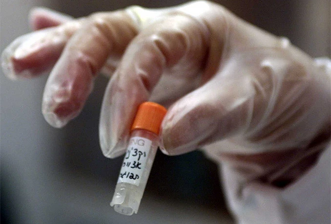 Ozbiljan propust: Prekasno upozorili na ebolu