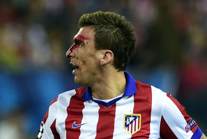 Mandžukić: Nije bilo ugriza, ni bilo čega