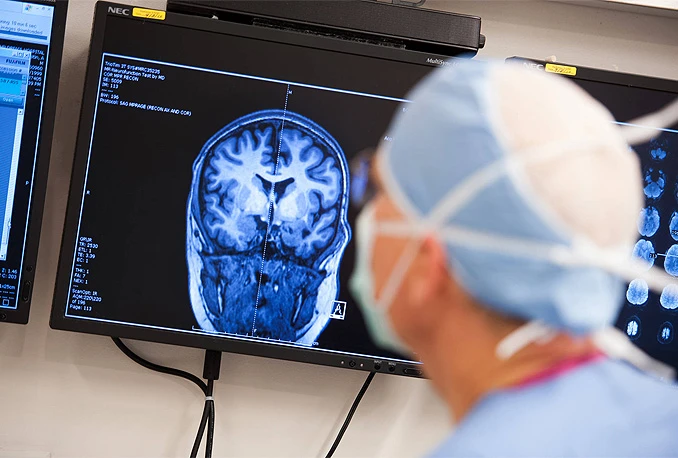 Godišnje se otkrije i do 800 slučajeva epilepsije
