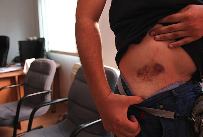 Incident na Buni: Policija je pokazala svu brutalnost na nama dvojici