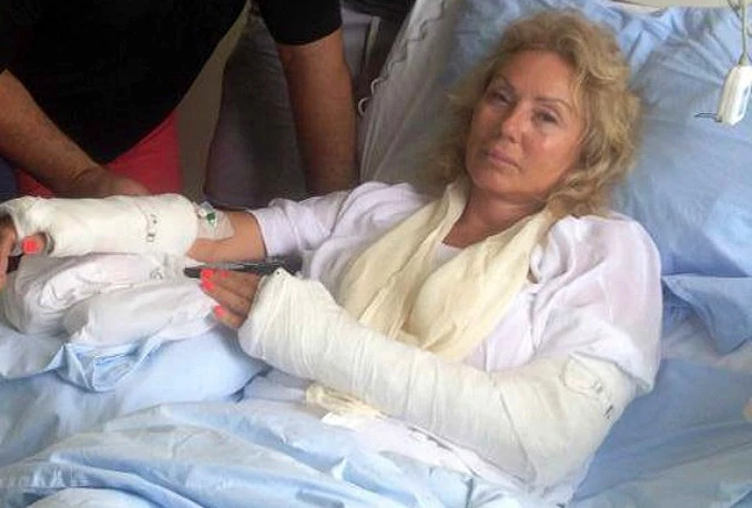 Lepa Brena pala i slomila ruku te završila u bolnici