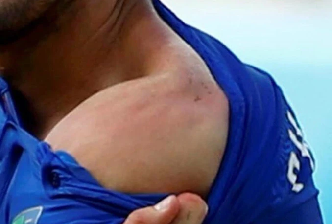 FIFA najavila istragu protiv Suareza