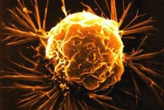 Hrvatski genetičar: Tumori su nastali prije 600 milijuna godina