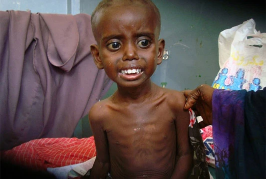 Somalija na 'vratima smrti'