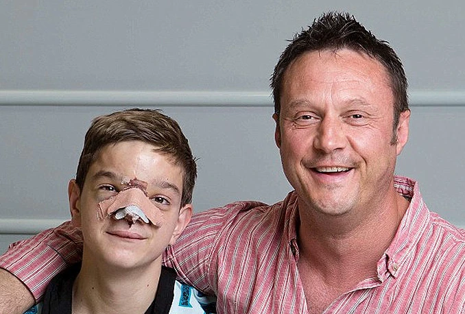 Britanski vojnik 14-godišnjem dječaku iz Laktaša skupio novac za novo lice
