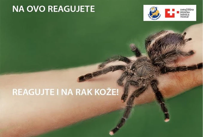 SKB Mostar: Besplatni preventivni pregledi kože