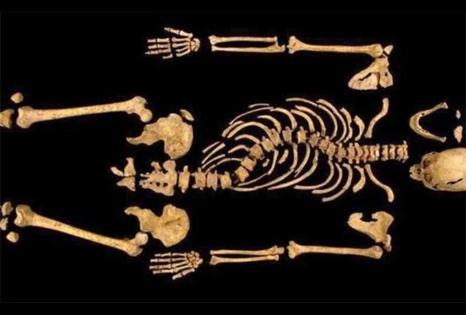 Arheolozi otkrili najraniji primjerak čovjeka s karcinomom