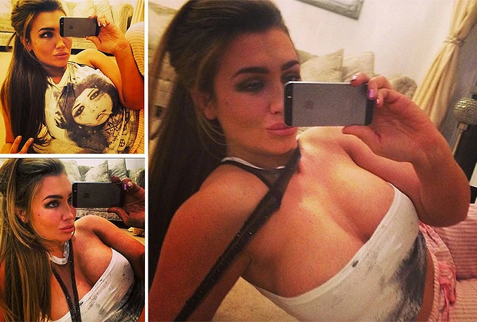 Zbog ''selfija'' sve više plastičnih operacija