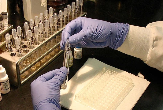 Uzeo milijune dolara za lažno otkriće lijeka za AIDS