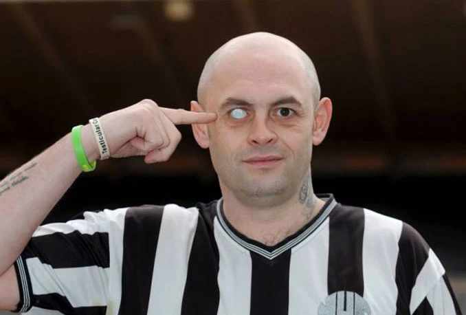 Navijač Newcastlea si stavio oko s klupskim grbom!